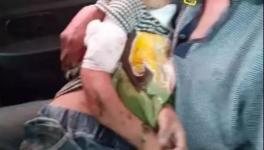 突發(fā)！血肉模糊！混凝土攪拌機(jī)把人活活攪死！